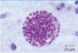 Microscopic cyst containing T. gondii from mouse brain tissue. A magnified purple object with multiple circles.